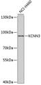 Potassium Calcium-Activated Channel Subfamily N Member 3 antibody, 22-016, ProSci, Western Blot image 