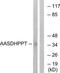 Aminoadipate-Semialdehyde Dehydrogenase-Phosphopantetheinyl Transferase antibody, TA315703, Origene, Western Blot image 
