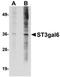 ST3 Beta-Galactoside Alpha-2,3-Sialyltransferase 6 antibody, orb75202, Biorbyt, Western Blot image 