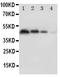 Platelet And Endothelial Cell Adhesion Molecule 1 antibody, PA1950, Boster Biological Technology, Western Blot image 