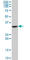 Uncoupling Protein 2 antibody, ab67241, Abcam, Western Blot image 