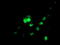 Ubiquitin Conjugating Enzyme E2 E3 antibody, TA504684, Origene, Immunofluorescence image 