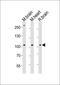 Serum/Glucocorticoid Regulated Kinase Family Member 3 antibody, orb1427, Biorbyt, Western Blot image 