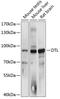 Denticleless protein homolog antibody, A01255, Boster Biological Technology, Western Blot image 