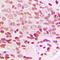 EGFR antibody, orb216093, Biorbyt, Immunohistochemistry paraffin image 