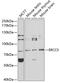 ERCC Excision Repair 3, TFIIH Core Complex Helicase Subunit antibody, GTX55844, GeneTex, Western Blot image 
