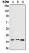 Dual Specificity Phosphatase 14 antibody, orb215037, Biorbyt, Western Blot image 