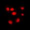 Heterogeneous nuclear ribonucleoproteins C1/C2 antibody, orb216129, Biorbyt, Immunocytochemistry image 