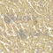 ATP Synthase F1 Subunit Beta antibody, A5769, ABclonal Technology, Immunohistochemistry paraffin image 