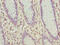 Solute Carrier Family 30 Member 6 antibody, CSB-PA744010LA01HU, Cusabio, Immunohistochemistry paraffin image 
