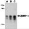 Collapsin Response Mediator Protein 1 antibody, MBS150713, MyBioSource, Western Blot image 