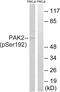 P21 (RAC1) Activated Kinase 2 antibody, GTX86345, GeneTex, Western Blot image 