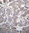 Secreted Frizzled Related Protein 5 antibody, abx027118, Abbexa, Immunohistochemistry paraffin image 