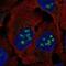 BLCAP Apoptosis Inducing Factor antibody, NBP2-54983, Novus Biologicals, Immunocytochemistry image 