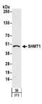 Serine hydroxymethyltransferase, cytosolic antibody, A304-259A, Bethyl Labs, Western Blot image 