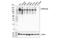 Protein Tyrosine Phosphatase Receptor Type F antibody, 61611S, Cell Signaling Technology, Western Blot image 