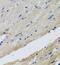 Ferrochelatase, mitochondrial antibody, FNab03070, FineTest, Immunohistochemistry paraffin image 