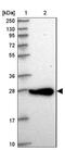 Coiled-Coil-Helix-Coiled-Coil-Helix Domain Containing 6 antibody, NBP1-91779, Novus Biologicals, Western Blot image 