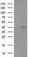 High affinity immunoglobulin gamma Fc receptor I antibody, TA506344, Origene, Western Blot image 