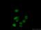 PHIP antibody, 20933-1-AP, Proteintech Group, Immunofluorescence image 