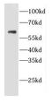Cell Division Cycle 25A antibody, FNab01521, FineTest, Western Blot image 