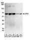 Bifunctional purine biosynthesis protein PURH antibody, A304-271A, Bethyl Labs, Western Blot image 