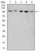 5'-3' Exoribonuclease 2 antibody, NBP2-61839, Novus Biologicals, Western Blot image 