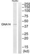 G Protein Subunit Alpha 14 antibody, PA5-39200, Invitrogen Antibodies, Western Blot image 