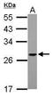 Proteasome Assembly Chaperone 1 antibody, GTX118921, GeneTex, Western Blot image 