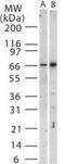 TNF Receptor Associated Factor 3 antibody, GTX13721, GeneTex, Western Blot image 