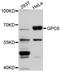 Glypican-6 antibody, LS-B15394, Lifespan Biosciences, Western Blot image 