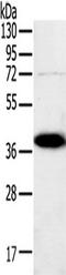 SPARC antibody, TA349441, Origene, Western Blot image 