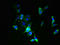 Zinc Finger DHHC-Type Containing 6 antibody, LS-C379313, Lifespan Biosciences, Immunofluorescence image 