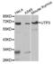 UTP3 Small Subunit Processome Component antibody, abx004605, Abbexa, Western Blot image 