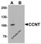 Cyclin T1 antibody, 7223, ProSci Inc, Western Blot image 