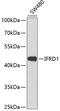 Interferon Related Developmental Regulator 1 antibody, 14-915, ProSci, Western Blot image 
