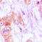 Cyclin Dependent Kinase Like 4 antibody, GTX56042, GeneTex, Immunohistochemistry paraffin image 