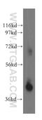 BTB/POZ domain-containing protein KCTD12 antibody, 15523-1-AP, Proteintech Group, Western Blot image 