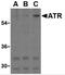ANTXR Cell Adhesion Molecule 1 antibody, 3119, ProSci Inc, Western Blot image 