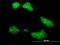 Ubiquitin-conjugating enzyme E2 Q2 antibody, H00092912-M04, Novus Biologicals, Immunocytochemistry image 