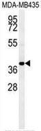 C-C chemokine receptor type 8 antibody, AP50827PU-N, Origene, Western Blot image 