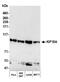 Kinesin Family Member 18A antibody, A301-080A, Bethyl Labs, Western Blot image 