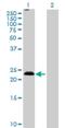 Membrane Spanning 4-Domains A5 antibody, H00064232-B01P, Novus Biologicals, Western Blot image 