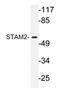 Signal Transducing Adaptor Molecule 2 antibody, AP20340PU-N, Origene, Western Blot image 