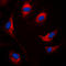 Suppressor Of Cytokine Signaling 1 antibody, LS-C354123, Lifespan Biosciences, Immunofluorescence image 