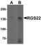Regulator Of G Protein Signaling 22 antibody, PA5-34426, Invitrogen Antibodies, Western Blot image 