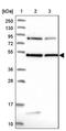 DENN Domain Containing 1B antibody, PA5-60036, Invitrogen Antibodies, Western Blot image 