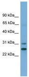 Dehydrogenase/Reductase 2 antibody, TA346418, Origene, Western Blot image 
