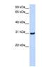 Ring Finger Protein 182 antibody, NBP1-59763, Novus Biologicals, Western Blot image 