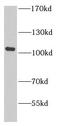 Complement C7 antibody, FNab01132, FineTest, Western Blot image 